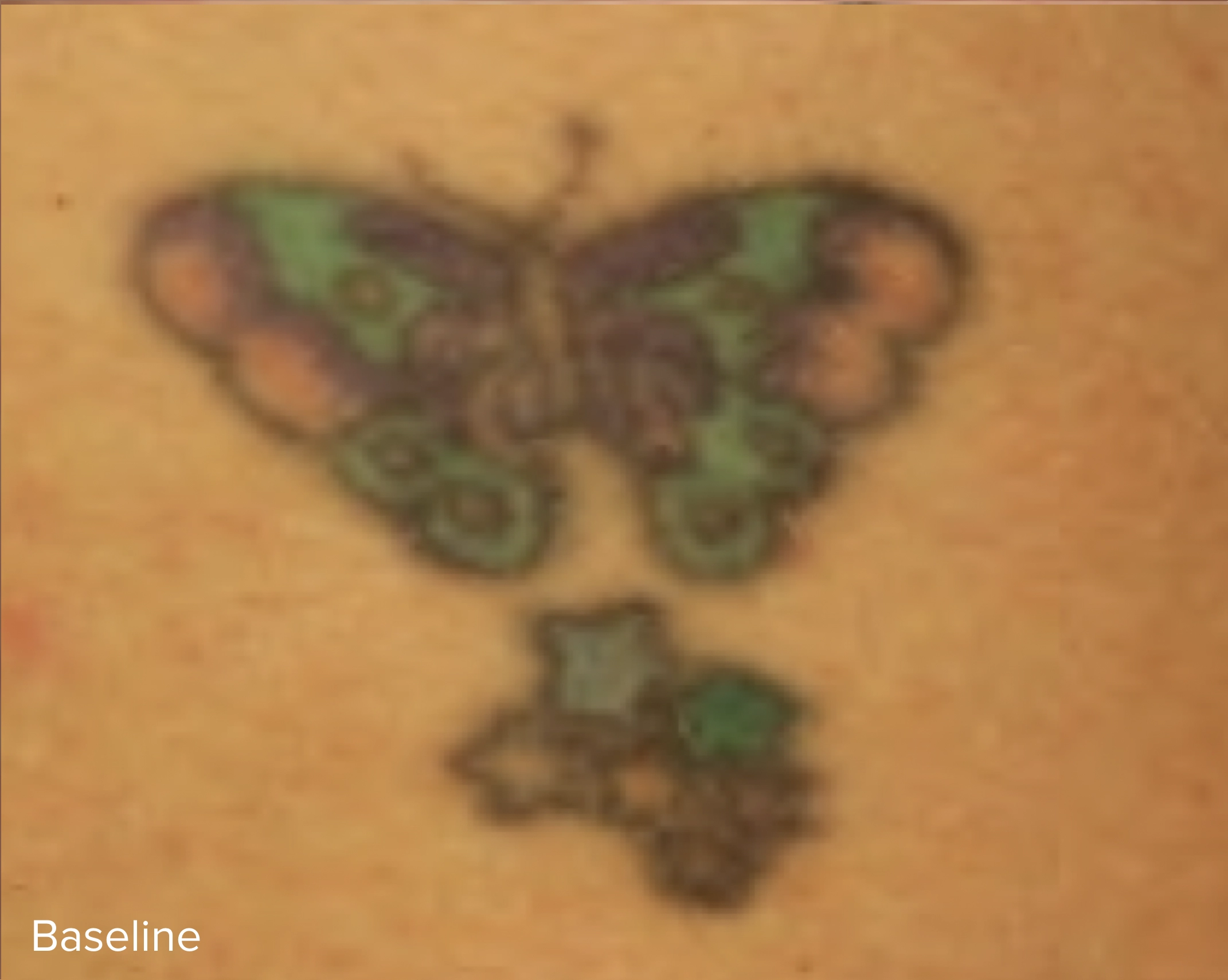 Laser Tattoo Removal Colour Baseline