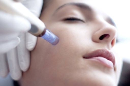 Woman receives microneedling treatment